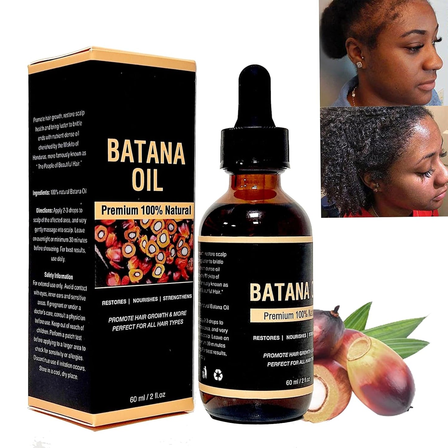 ACEITE DE BATANA - FORMULA MEJORADA 100% NATURAL