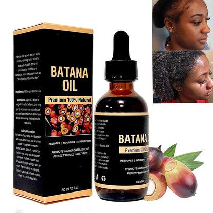 ACEITE DE BATANA - FORMULA MEJORADA 100% NATURAL